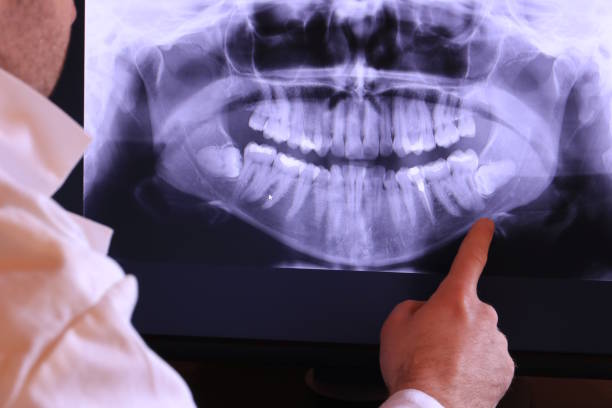 Best Emergency Cosmetic Dentistry in Fairbury, IL